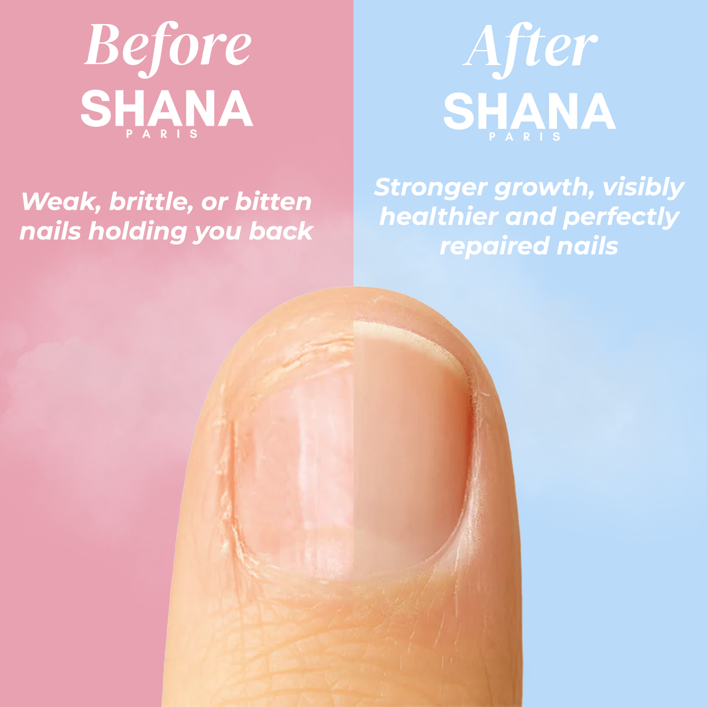 Shana Paris - Nail Growth Oil