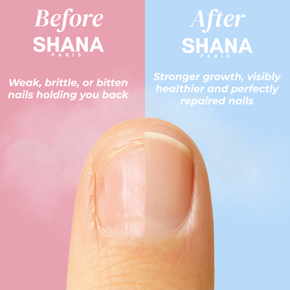 Shana Paris - Nail Growth Oil