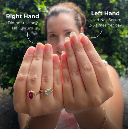 Shana Paris - Nail Growth Oil